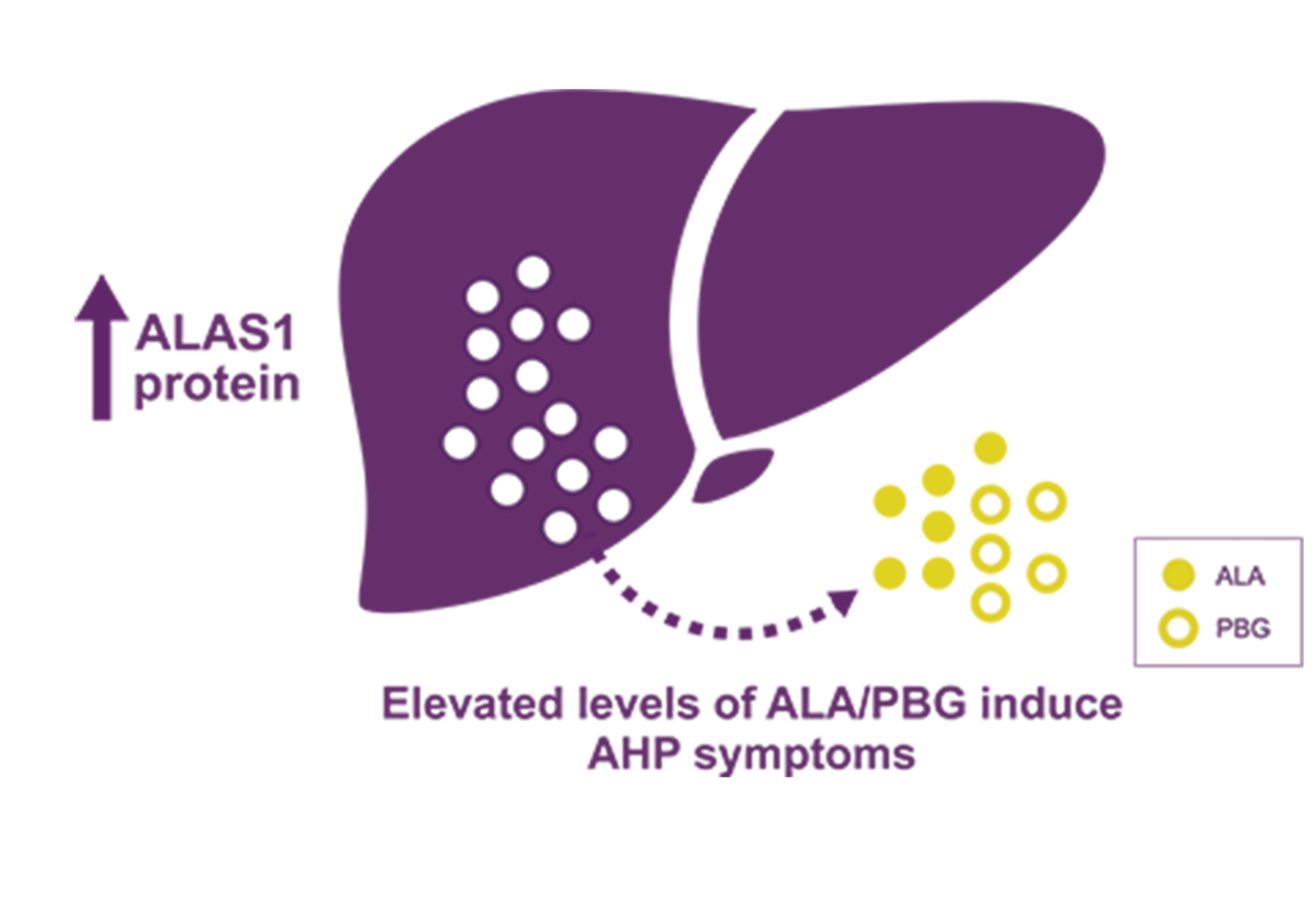 Upregulation of ALAS1 leads to neurotoxic accumulation of ALA and PBG