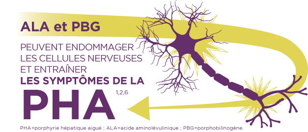 La porphyrie hépatique aiguë est causée par une accumulation de toxines, l’ALA et le PBG, dans le foie