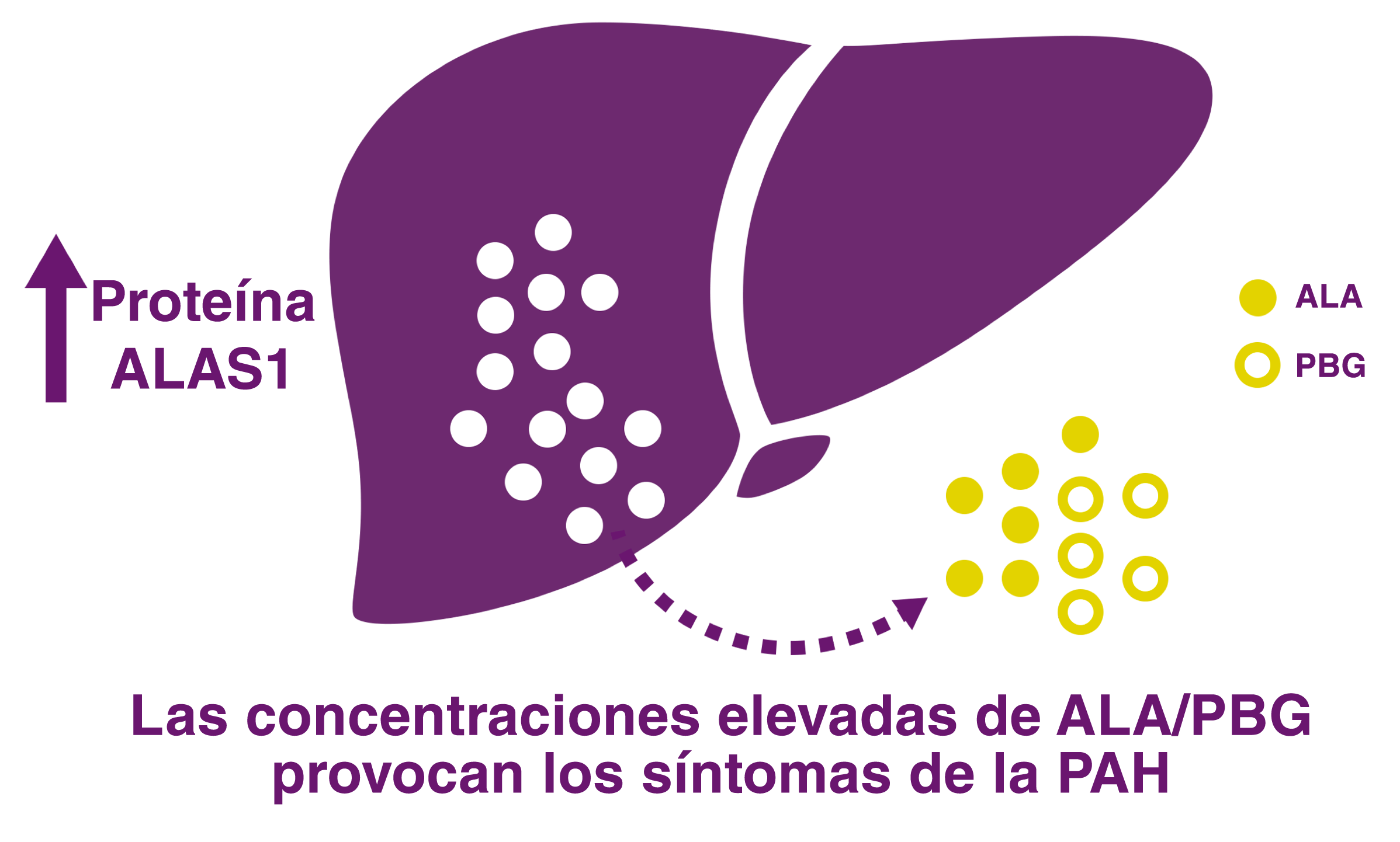 La regulación al alza del ALAS1 causa la acumulación neurotóxica de ALA y PBG